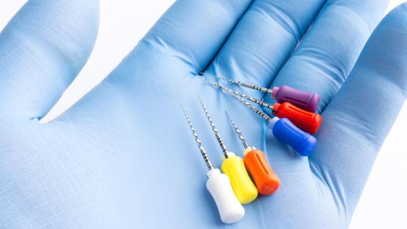 punte endodonzia per dentisti deposito martellago